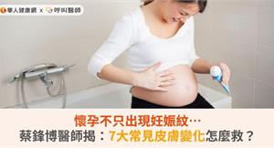 懷孕不只出現妊娠紋…蔡鋒博醫師揭：7大常見皮膚變化怎麼救？