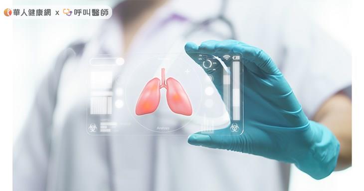 ALK陽性非小細胞肺癌好發於50歲左右、無菸史的女性身上。