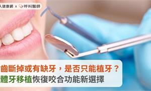 牙齒斷掉或有缺牙，是否只能植牙？自體牙移植恢復咬合功能新選擇