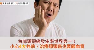 台灣頭頸癌發生率世界第一！小心4大共病，治療頭頸癌也要顧血管