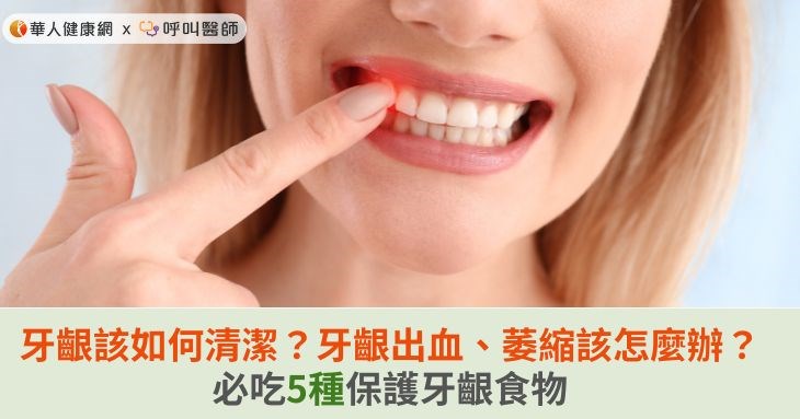 牙齦該如何清潔？牙齦出血、萎縮該怎麼辦？必吃5種保護牙齦食物