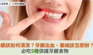 牙齦該如何清潔？牙齦出血、萎縮該怎麼辦？必吃5種保護牙齦食物