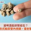 灌啤酒能排腎結石？次世代軟式輸尿管內視鏡，雷射擊碎頑石