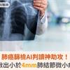 肺癌篩檢AI判讀神助攻！可揪出小於4mm肺結節微小病灶