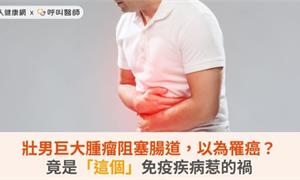 壯男巨大腫瘤阻塞腸道，以為罹癌？竟是「這個」免疫疾病惹的禍