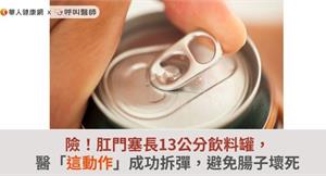 險！肛門塞長13公分飲料罐，「這動作」成功拆彈，避免腸子壞死