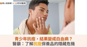 青少年抗痘，結果變成白血病？醫籲：了解抗痘保養品的隱藏危機