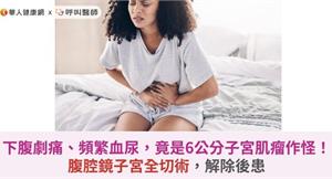 下腹劇痛、頻繁血尿，竟是6公分子宮肌瘤作怪！腹腔鏡子宮全切術，解除後患