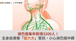 淋巴癌每年新增3200人！全身皮膚癢「這六大」警訊，小心淋巴癌中鏢