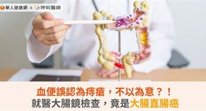 血便誤認為痔瘡，不以為意？！就醫大腸鏡檢查，竟是大腸直腸癌