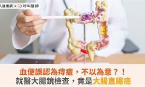 血便誤認為痔瘡，不以為意？！就醫大腸鏡檢查，竟是大腸直腸癌