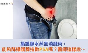 攝護腺水蒸氣消融術，能夠降攝護腺指數PSA嗎？醫師這樣說…