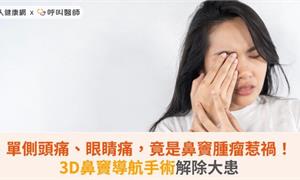 單側頭痛、眼睛痛，竟是鼻竇腫瘤惹禍！3D鼻竇導航手術解除大患