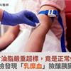 男三酸甘油脂嚴重超標，竟是正常值10倍！健檢發現「乳糜血」險釀胰臟炎