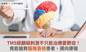 TMS經顱磁刺激不只能治療憂鬱症！竟能搶救腦傷昏迷患者，邁向康復