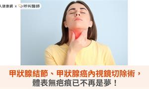 甲狀腺結節、甲狀腺癌內視鏡切除術，體表無疤痕已不再是夢！