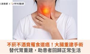 不菸不酒竟罹食道癌！大腸重建手術替代胃重建，助患者回歸正常生活