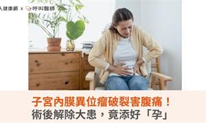 子宮內膜異位瘤破裂害腹痛！術後解除大患，竟添好「孕」