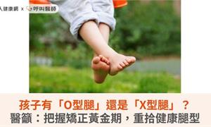 孩子有「O型腿」還是「X型腿」？醫籲：把握矯正黃金期，重拾健康腿型