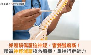 脊髓損傷壓迫神經，害雙腿癱瘓！精準神經減壓搶救癱瘓，重拾行走能力