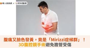 腹痛又臉色發黃，竟是「Mirizzi症候群」！3D腹腔鏡手術避免膽管受傷