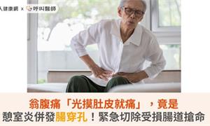 翁腹痛「光摸肚皮就痛」，竟是憩室炎併發腸穿孔！緊急切除受損腸道搶命