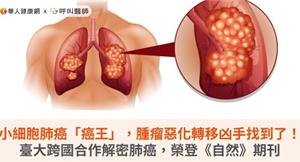 小細胞肺癌「癌王」，腫瘤惡化轉移凶手找到了！臺大跨國合作解密肺癌，榮登《自然》期刊