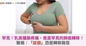 罕見！乳房腫脹疼痛，竟是罕見的肺癌轉移！醫揭：「這個」恐是轉移路徑