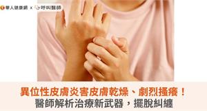 異位性皮膚炎害皮膚乾燥、劇烈搔癢！醫師解析治療新武器，擺脫糾纏