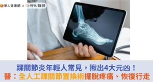 踝關節炎年輕人常見，揪出4大元凶！醫：全人工踝關節置換術擺脫疼痛、恢復行走