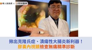 揪出克隆氏症、潰瘍性大腸炎新利器！膠囊內視鏡檢查無痛精準診斷