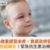 9歲童感冒未癒，竟感染併發眼窩蜂窩性組織炎！緊急抗生素治療恢復健康