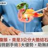腹痛、腹脹，竟是3公分大膽結石惹禍！達文西微創手術3大優勢，助無痕康復