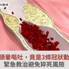 糖尿病男頭暈嘔吐送急診，竟是3條冠狀動脈阻塞！緊急救治避免猝死風險