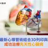 東亞首例！最新心導管術結合3D列印與覆膜支架，成功治療先天性心臟病