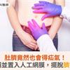 肚臍竟然也會得疝氣！手術修補並置入人工網膜，擺脫臍疝氣困擾