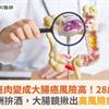 腺瘤性瘜肉變成大腸癌風險高！28歲女業務應酬拚酒，大腸鏡揪出高風險瘜肉