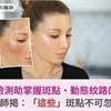 AI肌膚檢測幫妳掌握斑點、動態紋路的問題！醫師揭：「這些」斑點不可忽視