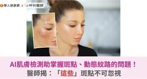 AI肌膚檢測幫妳掌握斑點、動態紋路的問題！醫師揭：「這些」斑點不可忽視