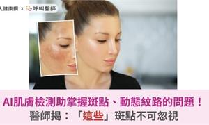 AI肌膚檢測幫妳掌握斑點、動態紋路的問題!醫師揭:「這些」斑點不可忽視