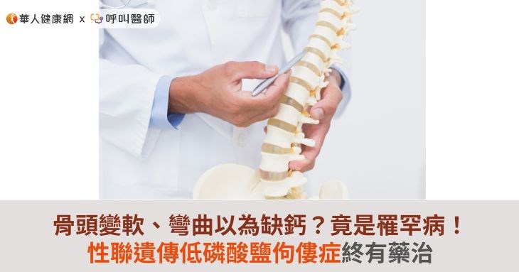 骨頭變軟、彎曲以為缺鈣?竟是罹罕病!性聯遺傳低磷酸鹽佝僂症終有藥治