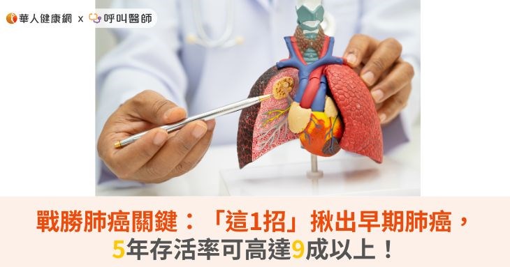 戰勝肺癌關鍵:「這1招」揪出早期肺癌,5年存活率可高達9成以上!