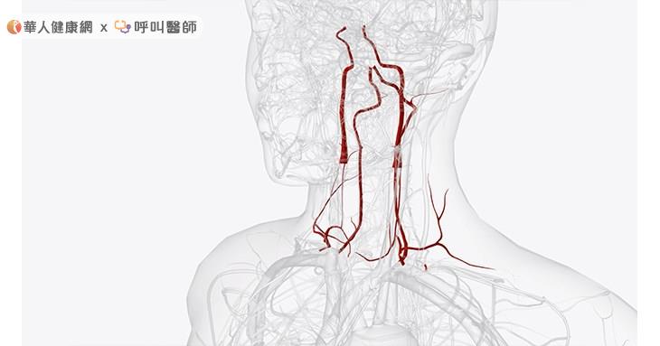 民眾若有高血壓、糖尿病或吸菸等心血管危險因子,更應維持良好生活習慣與規律服藥,以降低血管阻塞風險。