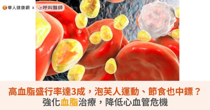 高血脂盛行率達3成,泡芙人運動、節食也中鏢?強化血脂治療,降低心血管危機