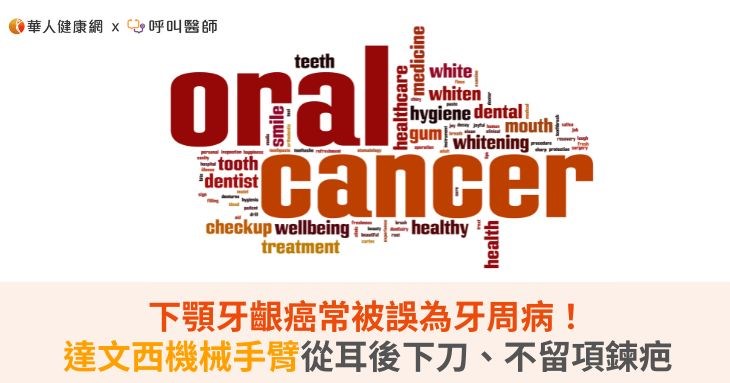 下顎牙齦癌常被誤為牙周病!達文西機械手臂從耳後下刀、不留項鍊疤