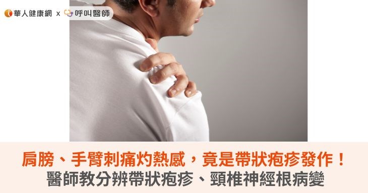 肩膀、手臂刺痛灼熱感,竟是帶狀疱疹發作!醫師教分辨帶狀疱疹、頸椎神經根病變