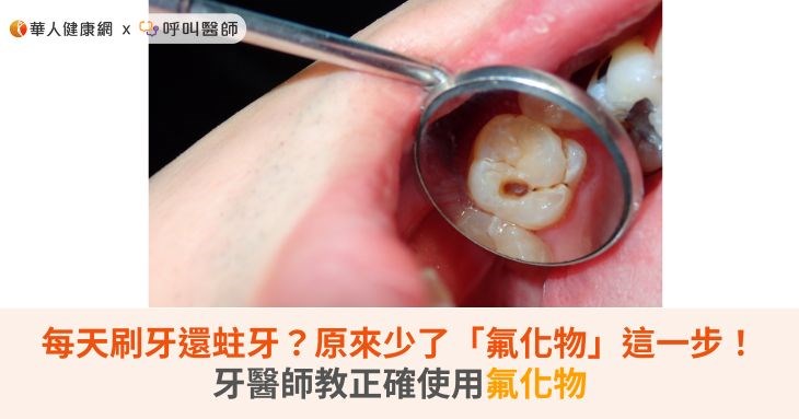 每天刷牙還蛀牙?原來少了「氟化物」這一步!牙醫師教正確使用氟化物