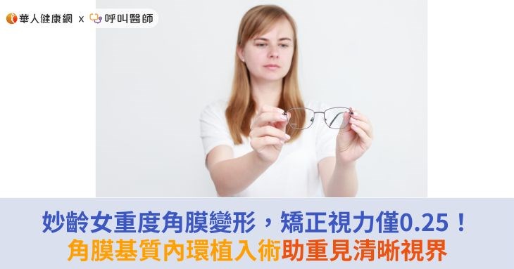 妙齡女重度角膜變形,矯正視力僅0.25!角膜基質內環植入術助重見清晰視界