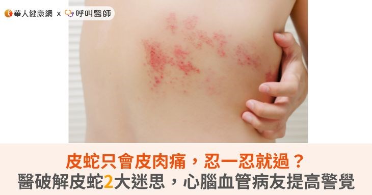 皮蛇只會皮肉痛,忍一忍就過?醫破解皮蛇2大迷思,心腦血管病友提高警覺