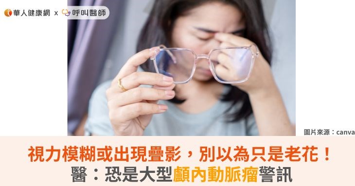 視力模糊或出現疊影,別以為只是老花!醫:恐是大型顱內動脈瘤警訊